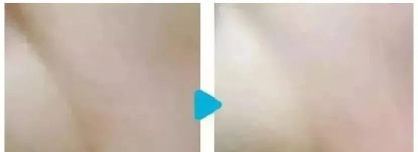 日本医疗,日本体检,日本美容,再生医疗,干细胞,美容,体检,医疗, 日本医疗,日本体检,日本美容,再生医疗,干细胞,美容,体检,医疗,