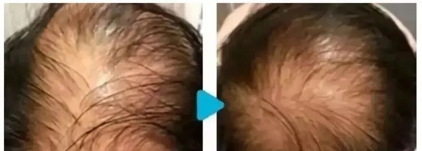 日本医疗,日本体检,日本美容,再生医疗,干细胞,美容,体检,医疗, 日本医疗,日本体检,日本美容,再生医疗,干细胞,美容,体检,医疗,